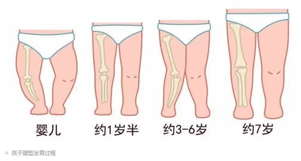 北京育儿嫂公司：宝宝什么样的腿型属正常？(图1)